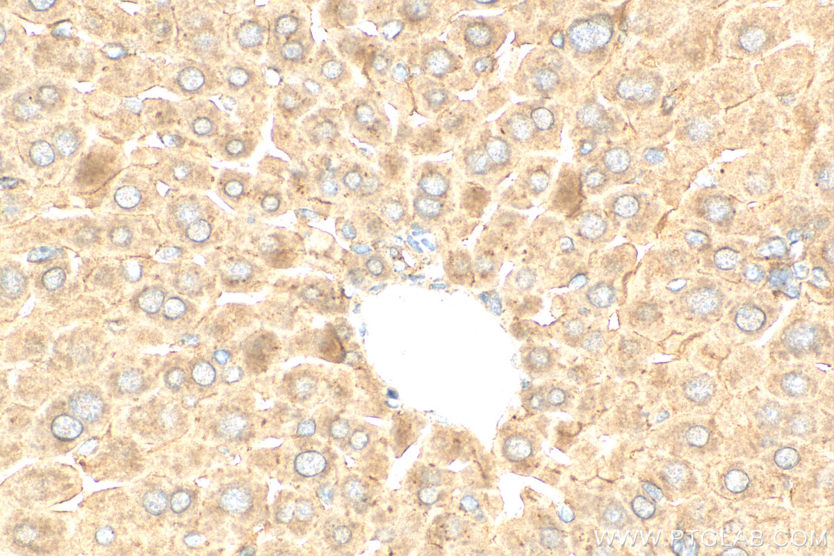 IHC staining of mouse liver using 29993-1-AP