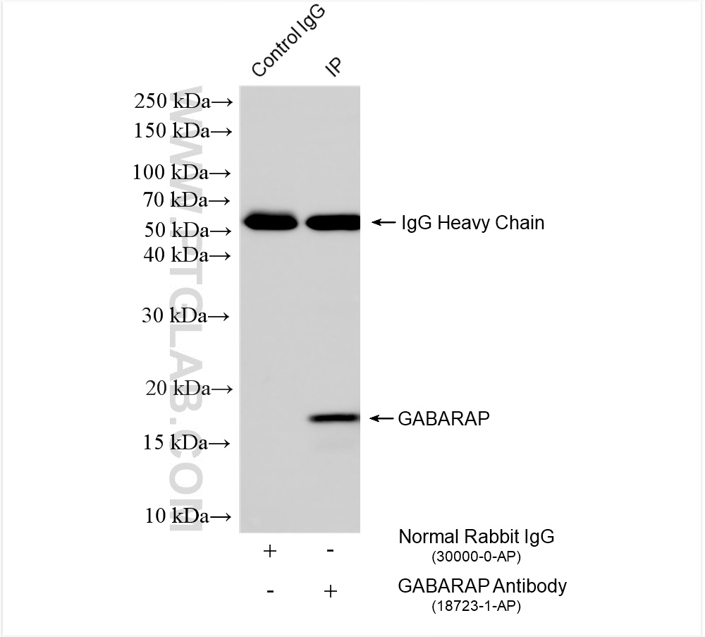 IP experiment of HeLa using 18723-1-AP