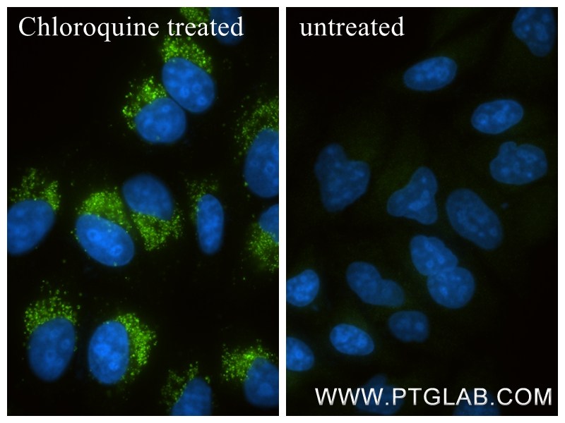 IF Staining of HepG2 using 86165-3-RR IF Staining of HepG2 using 86165-3-RR