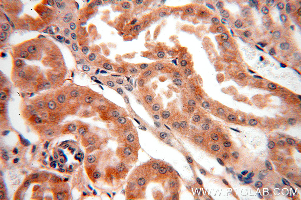 IHC staining of human kidney using 18721-1-AP