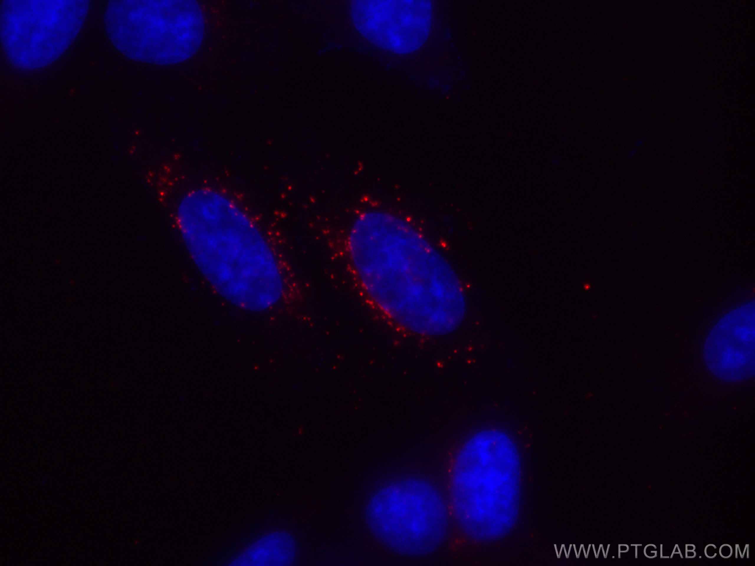 IF Staining of HepG2 using CL594-66458