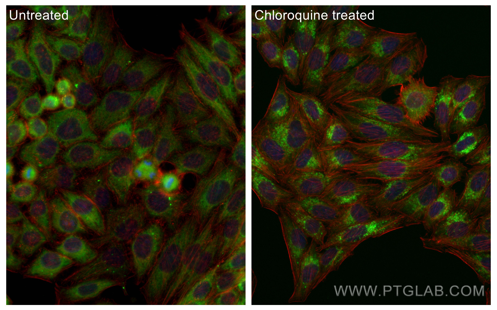 GABARAPL1-Specific