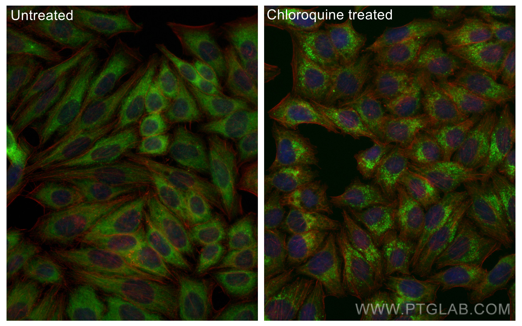 IF Staining of HepG2 using CL488-11010