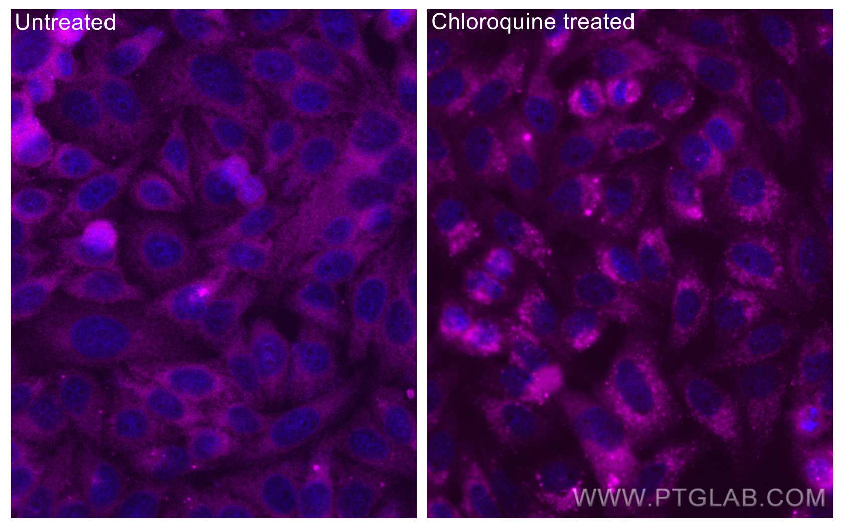 IF Staining of HepG2 using CL647-11010