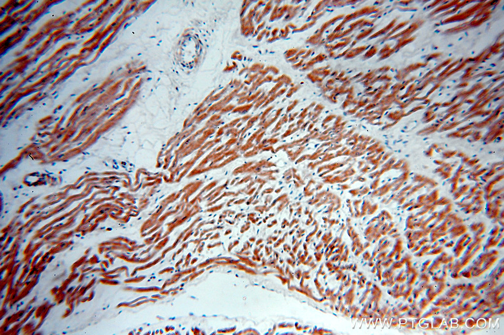 IHC staining of human heart using 18724-1-AP