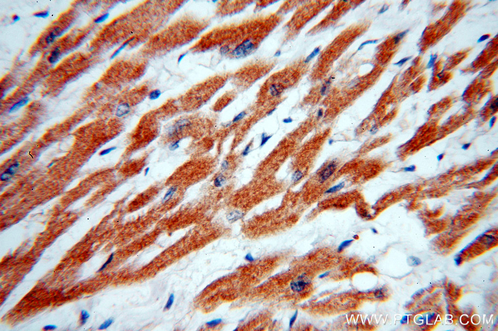 IHC staining of human heart using 18724-1-AP