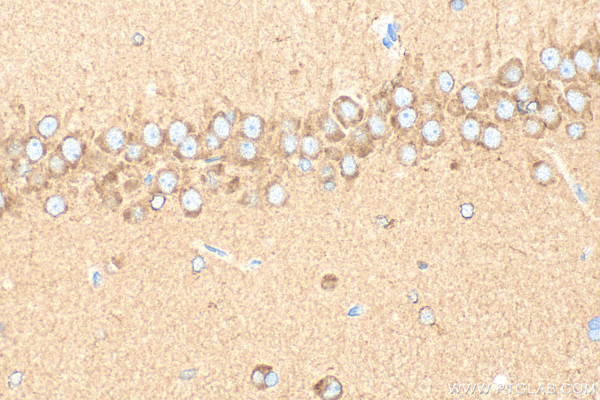 IHC staining of rat brain using 13940-1-AP