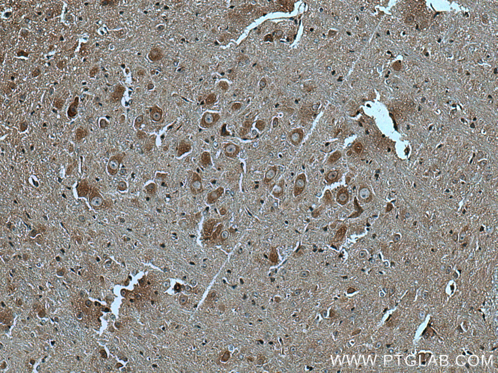 IHC staining of mouse cerebellum using 27567-1-AP