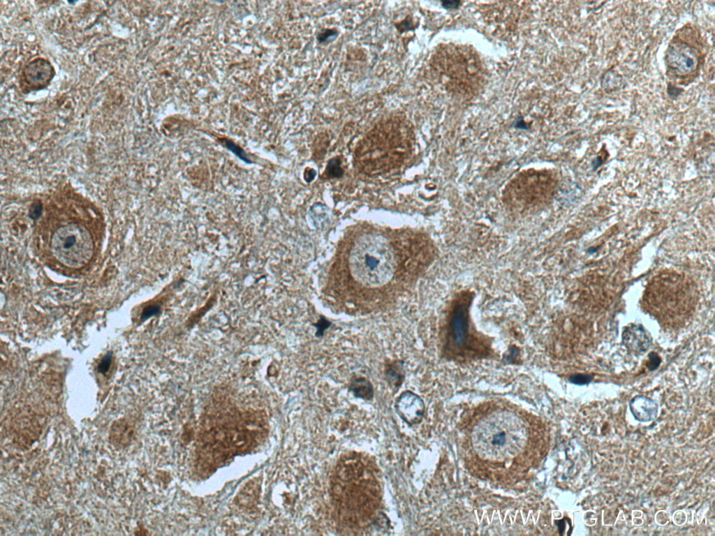 IHC staining of mouse cerebellum using 27567-1-AP