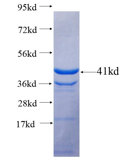 GABBR2 fusion protein Ag25759 SDS-PAGE