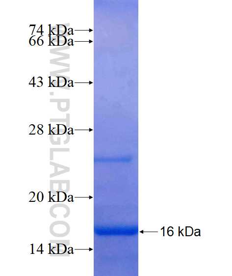 GABPB2 fusion protein Ag15464 SDS-PAGE GABPB2 fusion protein Ag15464 SDS-PAGE
