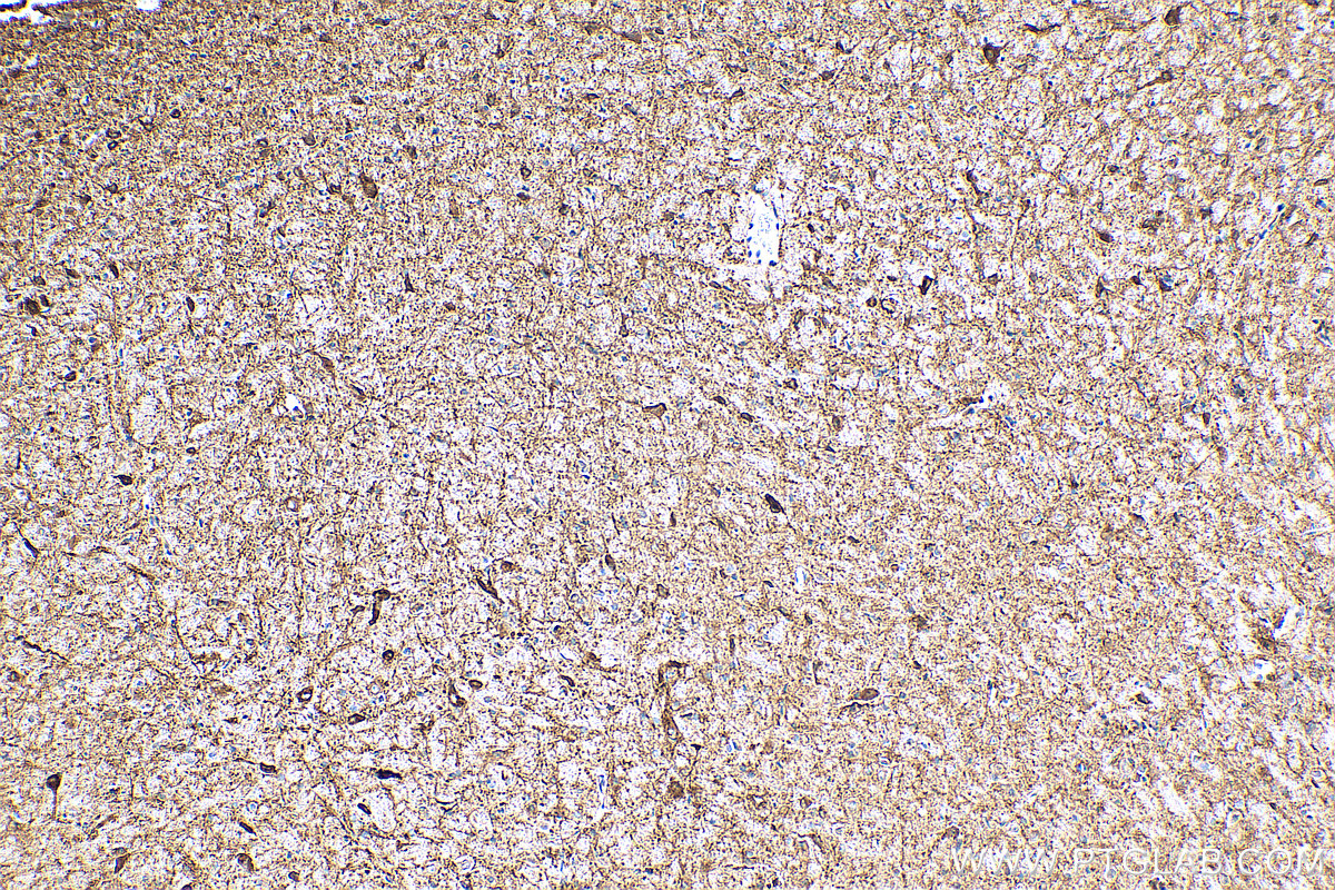 IHC staining of rat brain using 12410-1-AP