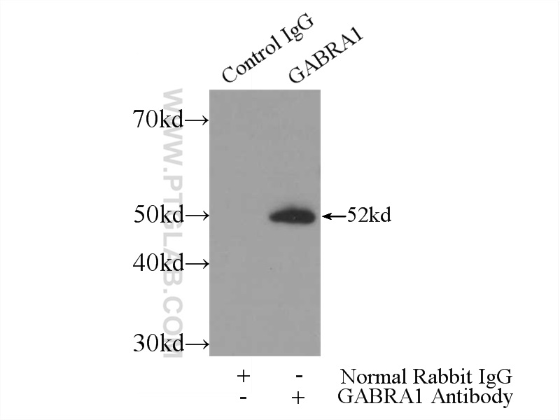 IP experiment of mouse brain using 12410-1-AP