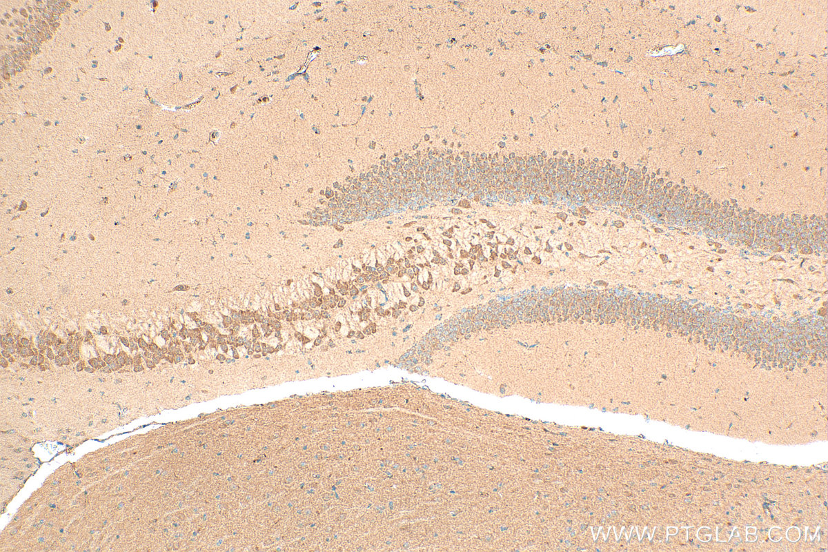 IHC staining of mouse brain using 12979-1-AP