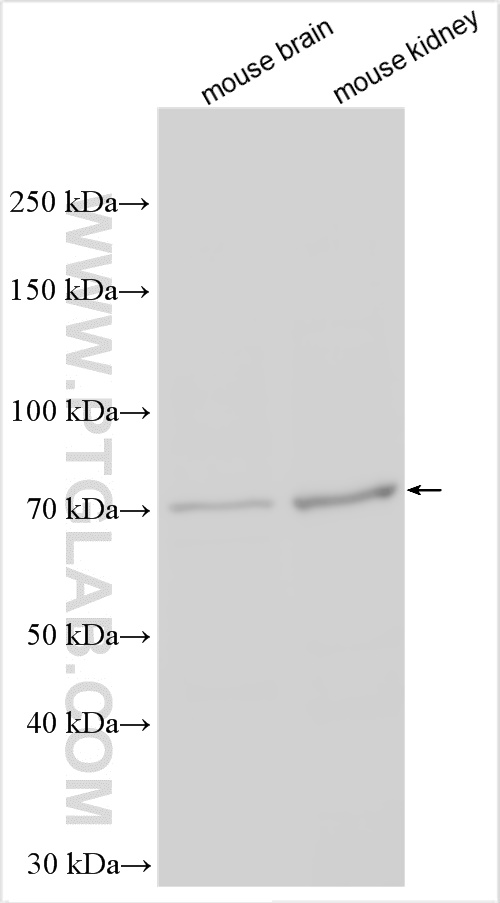 WB analysis using 12979-1-AP