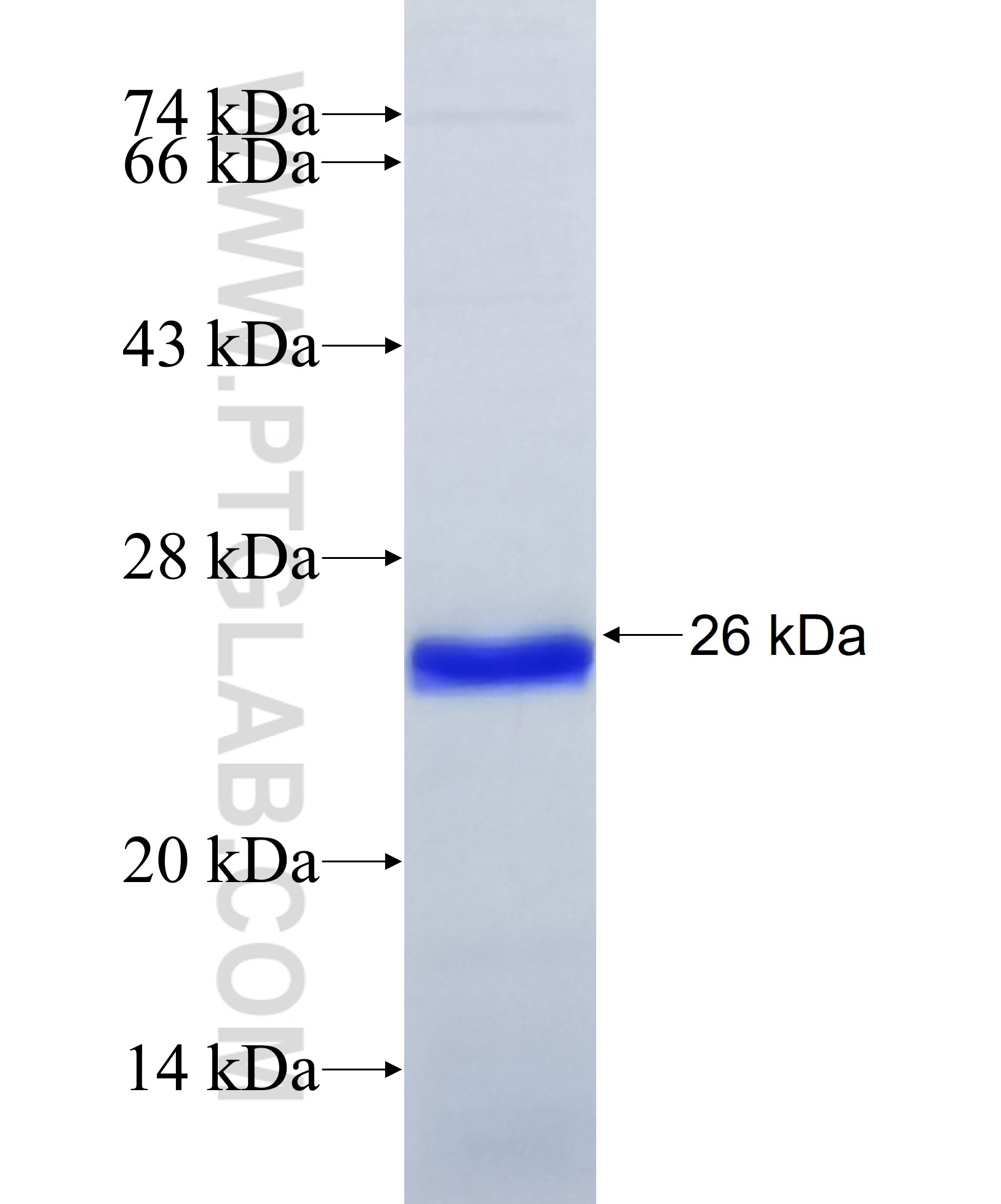 GABRA4 fusion protein Ag31581 SDS-PAGE GABRA4 fusion protein Ag31581 SDS-PAGE