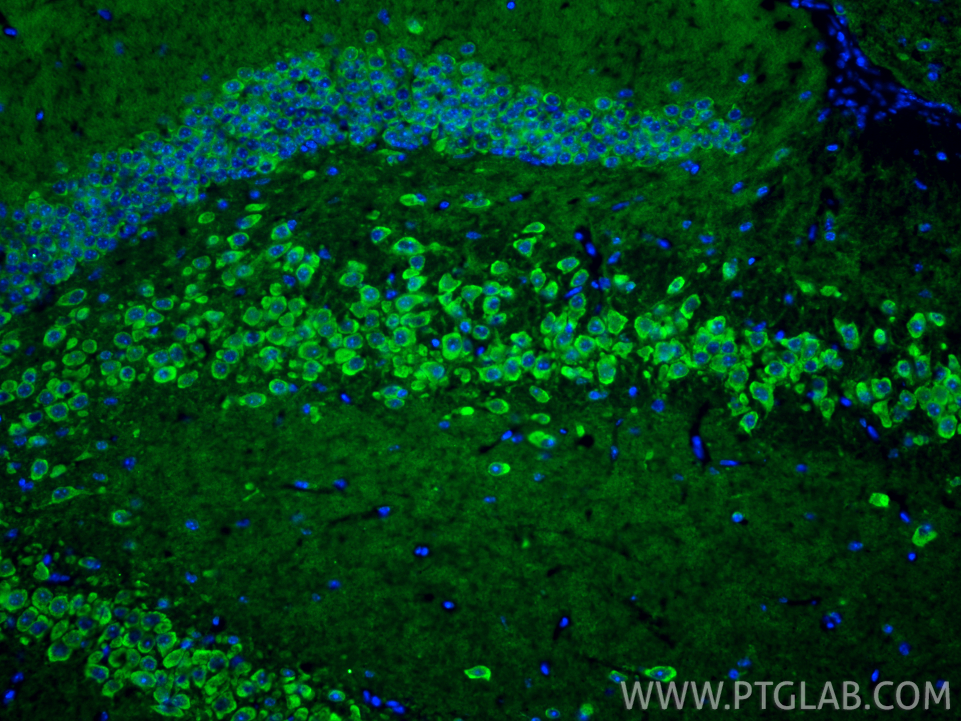IF Staining of mouse brain using 27929-1-AP