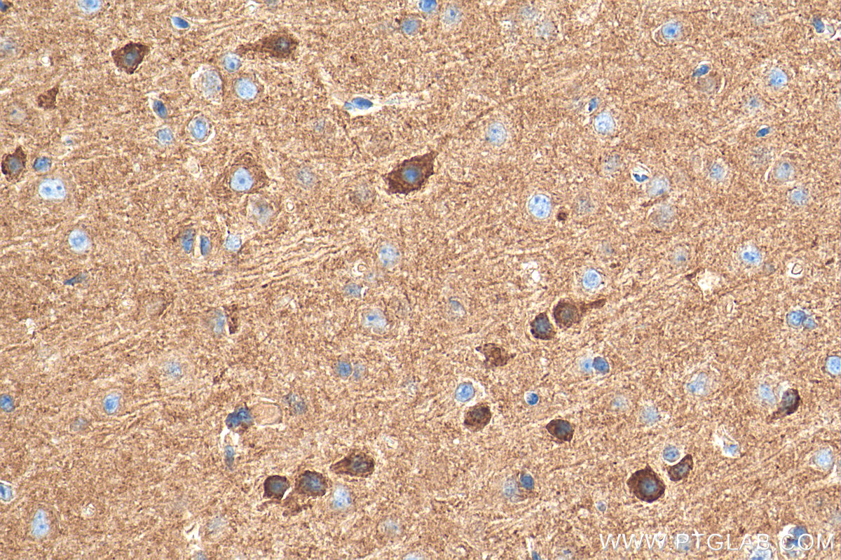 IHC staining of mouse brain using 27929-1-AP