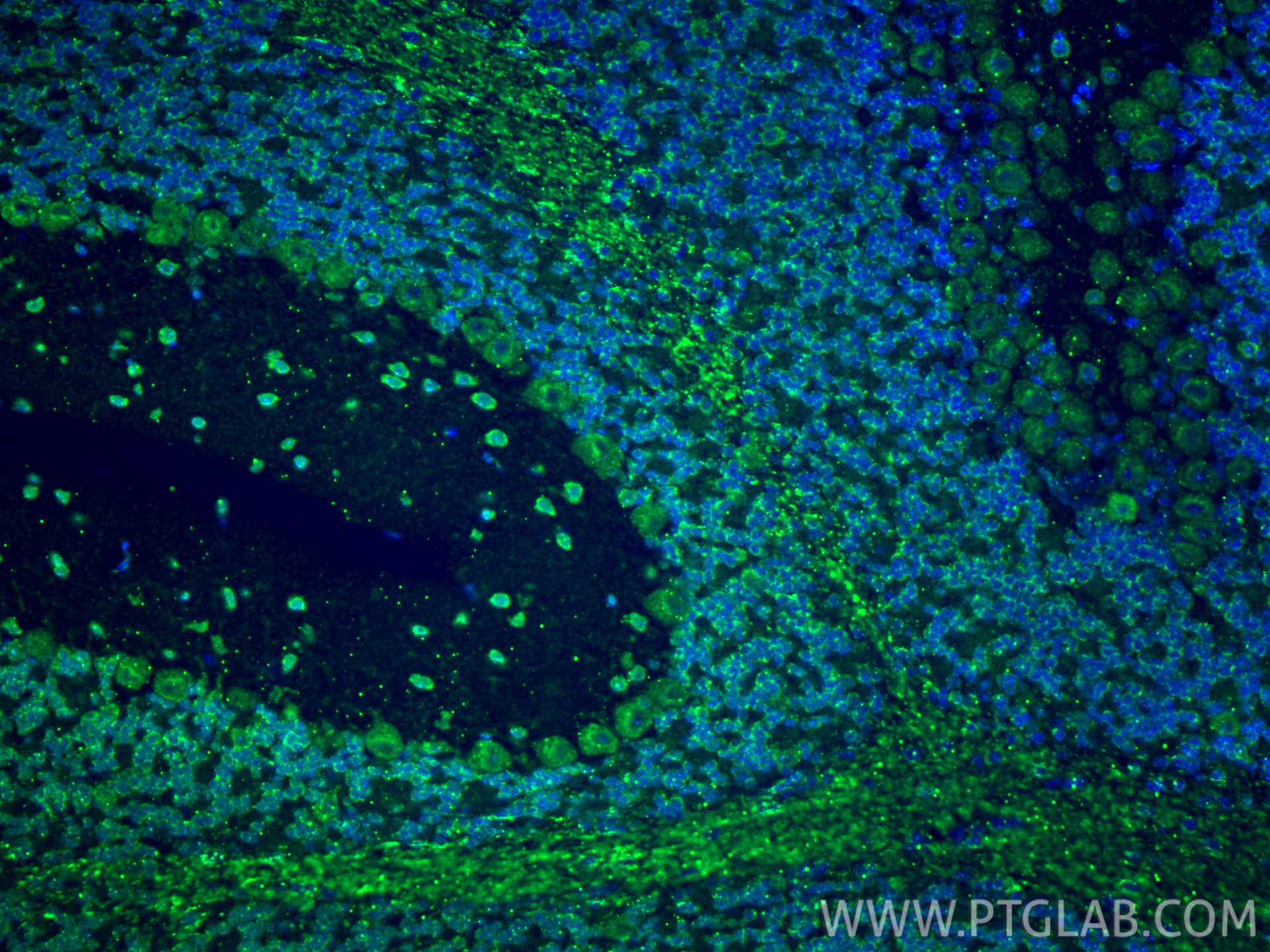 Immunofluorescent analysis of (4% PFA) fixed paraffin-embedded mouse cerebellum tissue using GABRA6 antibody (21766-1-AP) at dilution of 1:500 and CoraLite®488-Conjugated Goat Anti-Rabbit IgG(H+L) (<a class='green' href='/productredirect?CatalogNo=SA00013-2' target='_blank'>SA00013-2</a>). Heat mediated antigen retrieval with Tris-EDTA buffer (pH 9.0). IF Staining of mouse cerebellum using 21766-1-AP