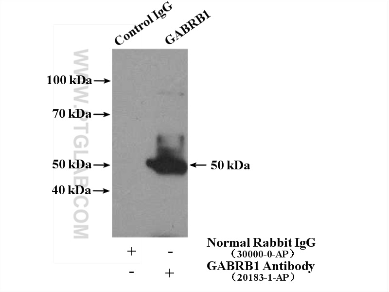 IP experiment of mouse testis using 20183-1-AP