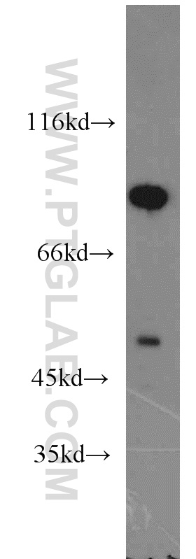 WB analysis of mouse testis using 20183-1-AP