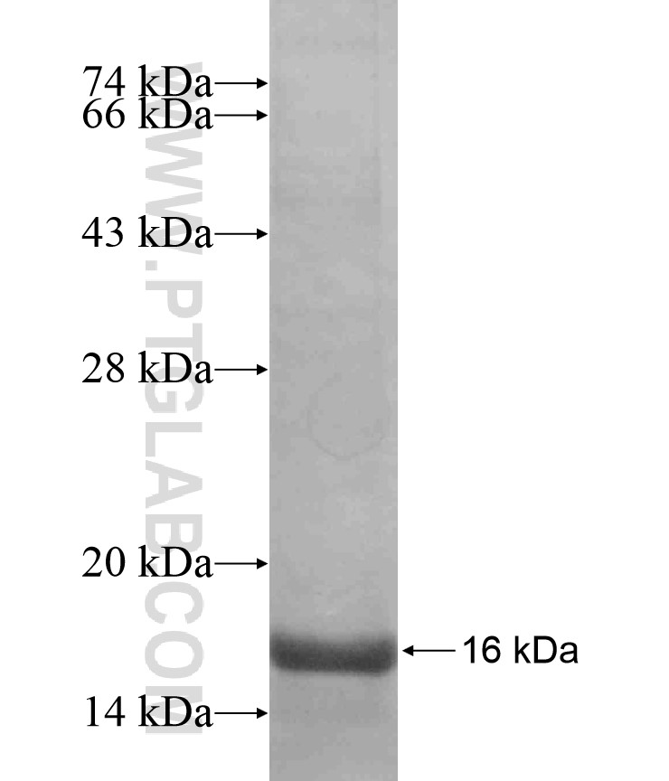 GABRB2 fusion protein Ag17477 SDS-PAGE