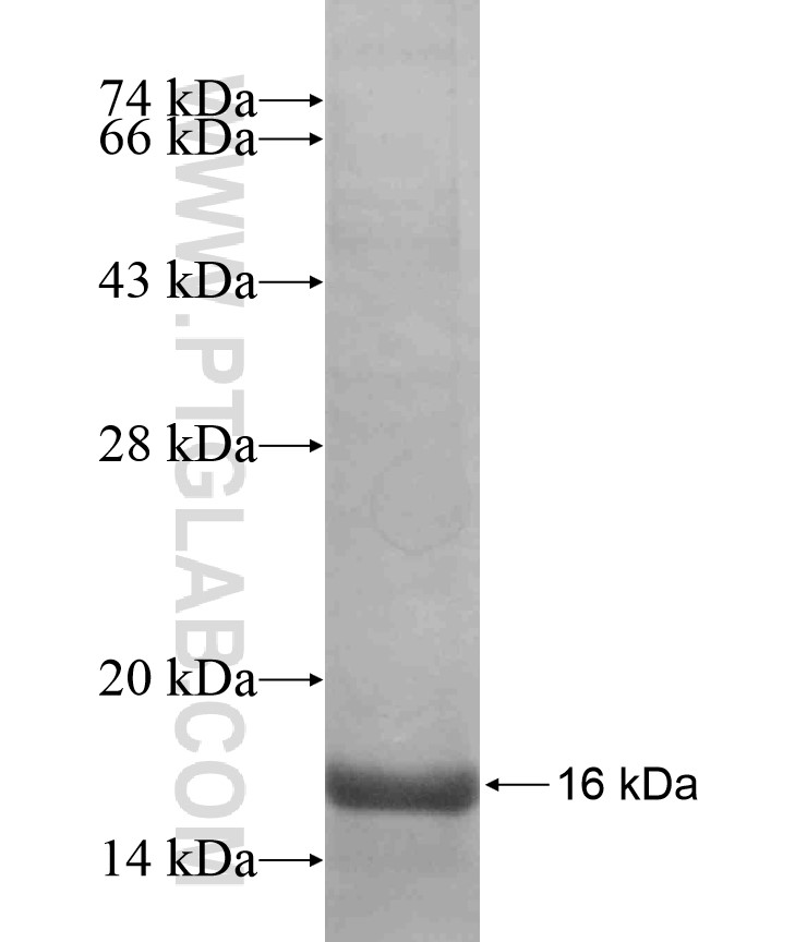 GABRB2 fusion protein Ag17477 SDS-PAGE GABRB2 fusion protein Ag17477 SDS-PAGE