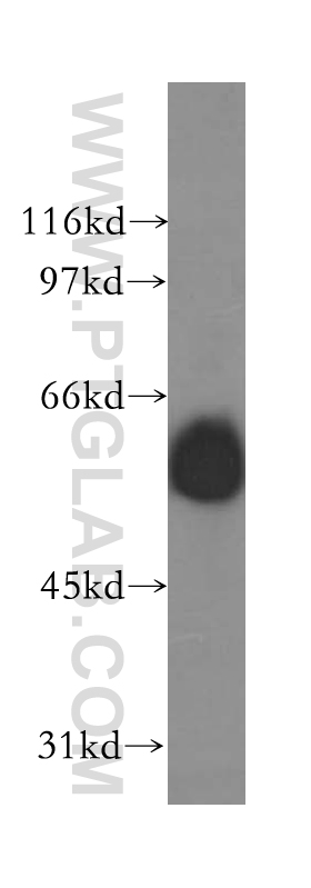 GABRG1 Polyclonal antibody