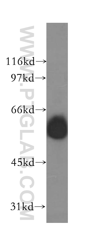 WB analysis of mouse eye using 12871-1-AP