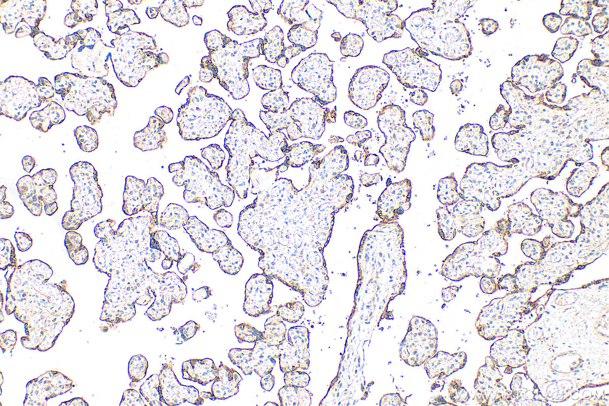 IHC staining of human placenta using 30642-1-AP