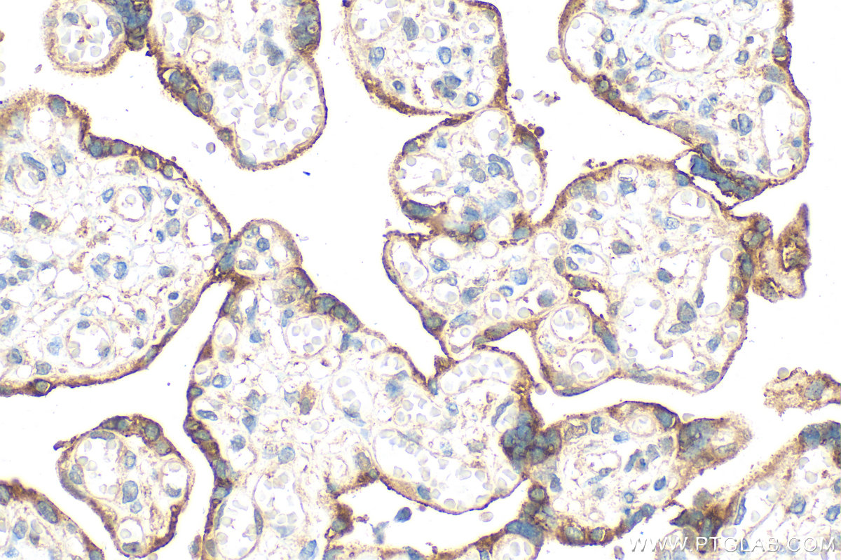 IHC staining of human placenta using 30642-1-AP