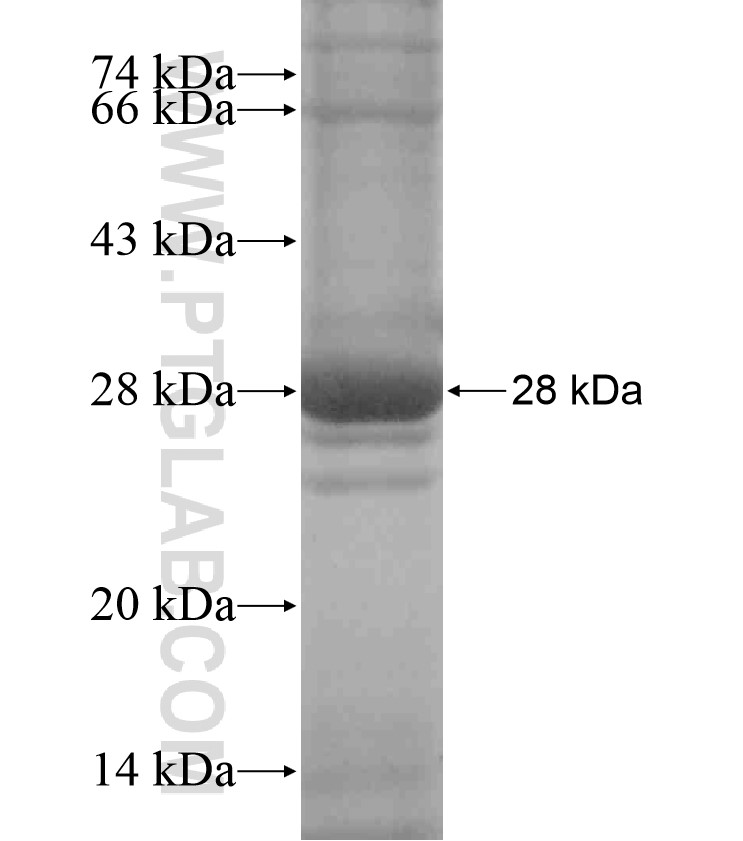 GABRQ fusion protein Ag17985 SDS-PAGE GABRQ fusion protein Ag17985 SDS-PAGE