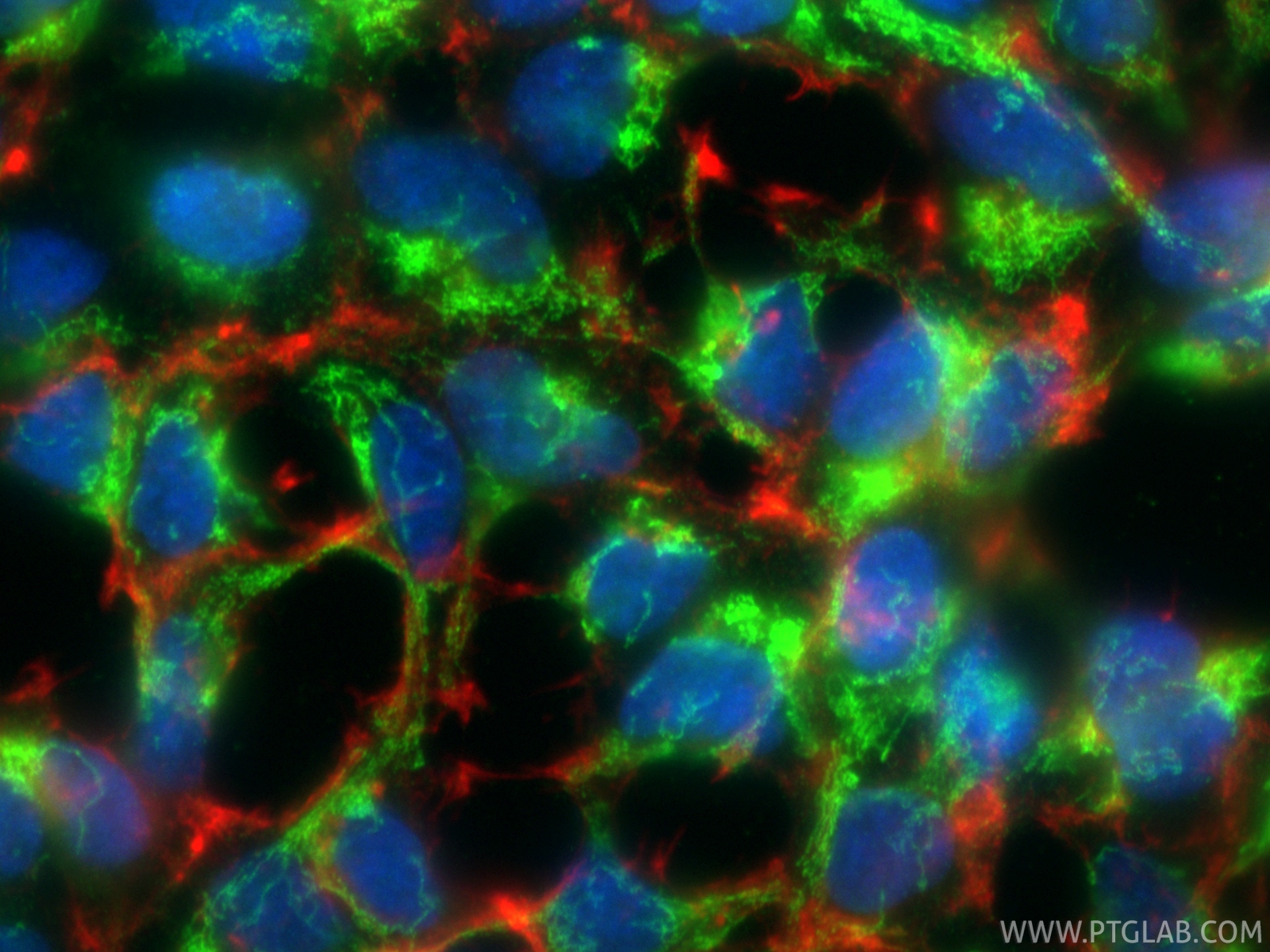 IF Staining of HEK-293 using 19958-1-AP