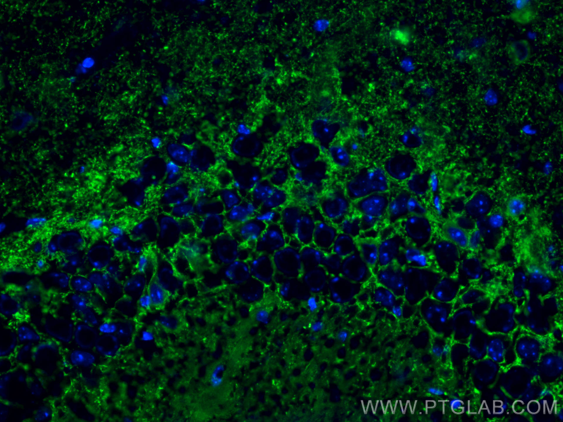 IF Staining of mouse brain using 10408-1-AP