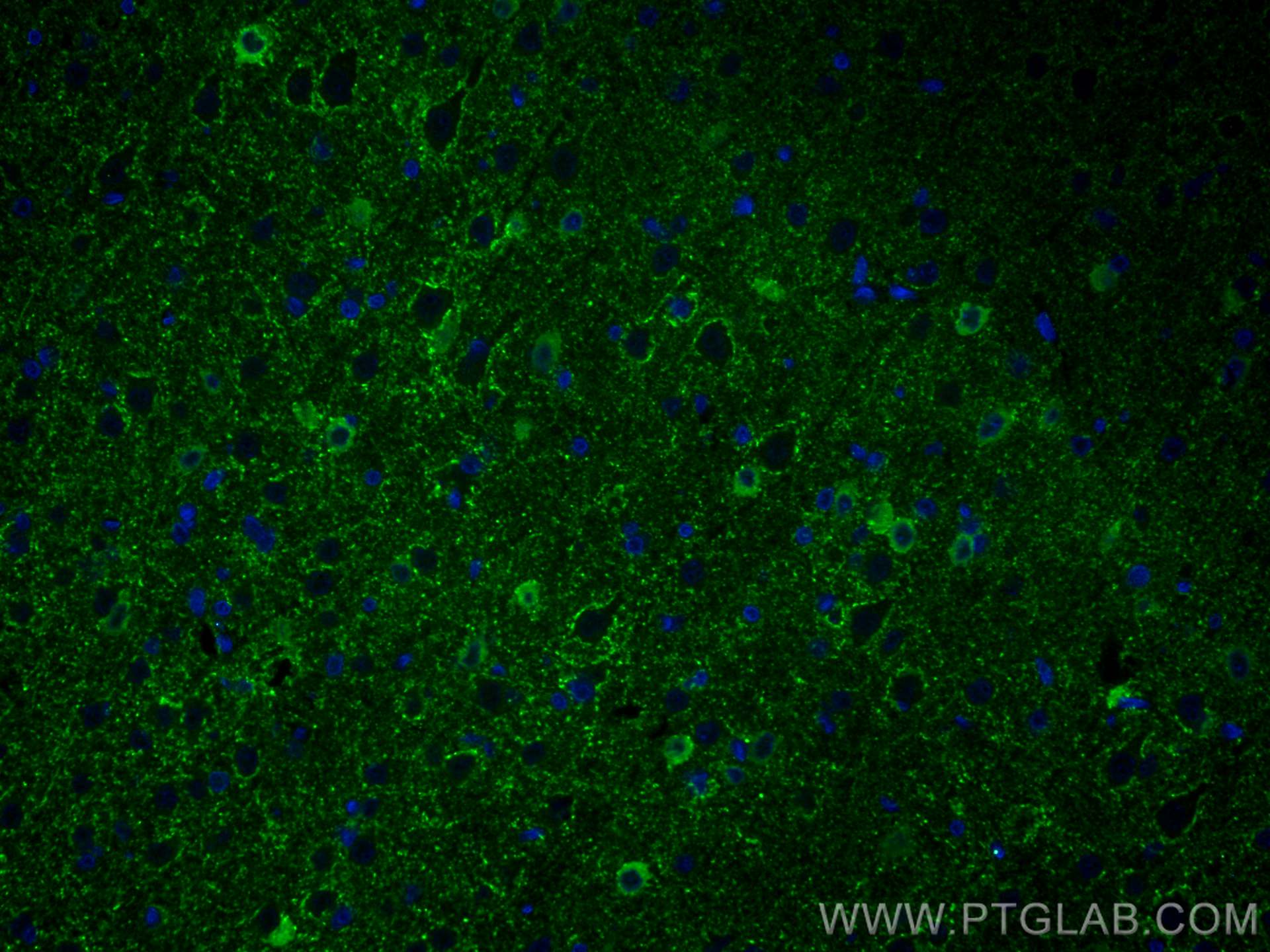 IF Staining of rat brain using 67648-1-Ig (same clone as 67648-1-PBS)