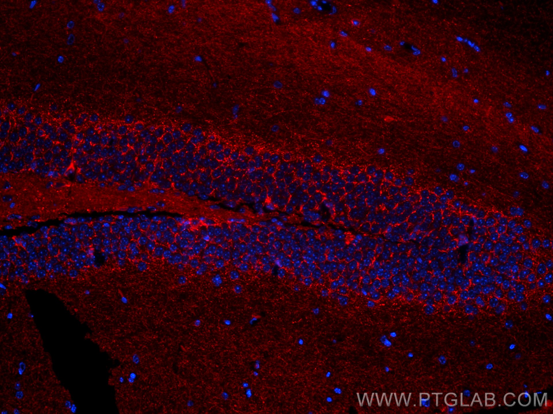 IF Staining of mouse brain using CL594-67648