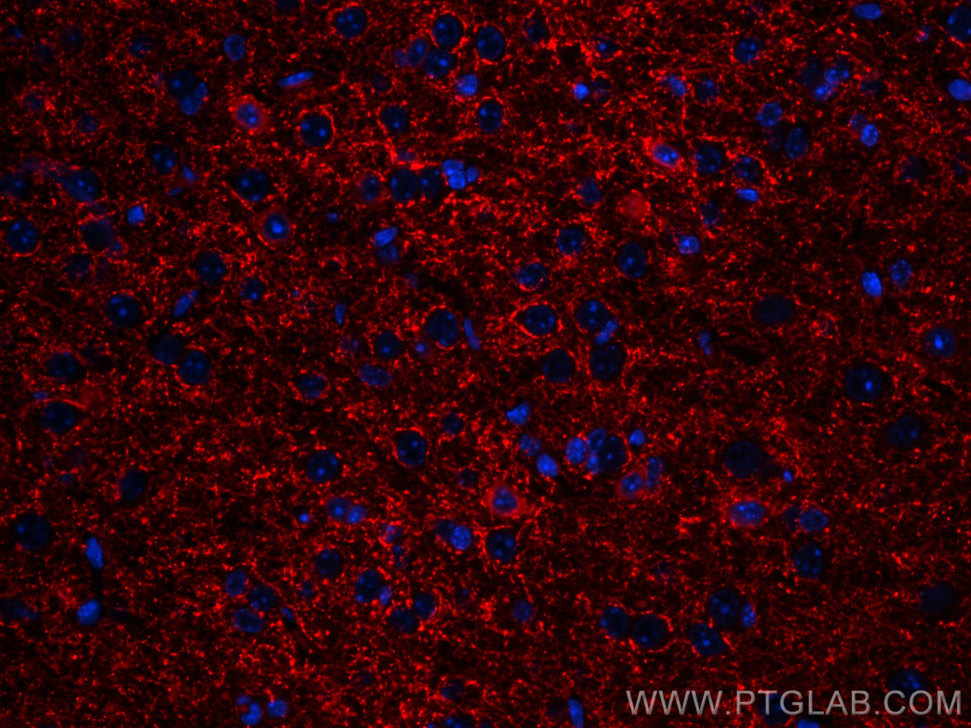 IF Staining of mouse brain using CL594-67648