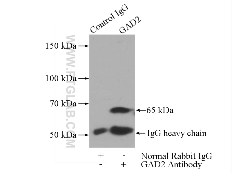 IP experiment of mouse brain using 20746-1-AP