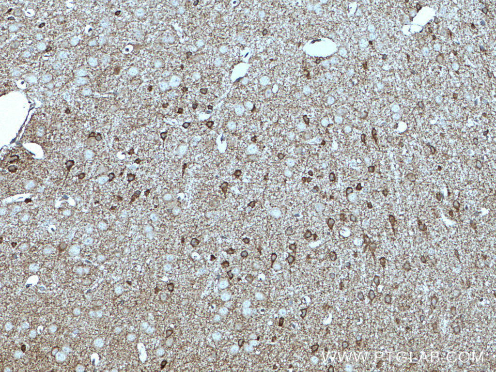 IHC staining of mouse brain using 21760-1-AP
