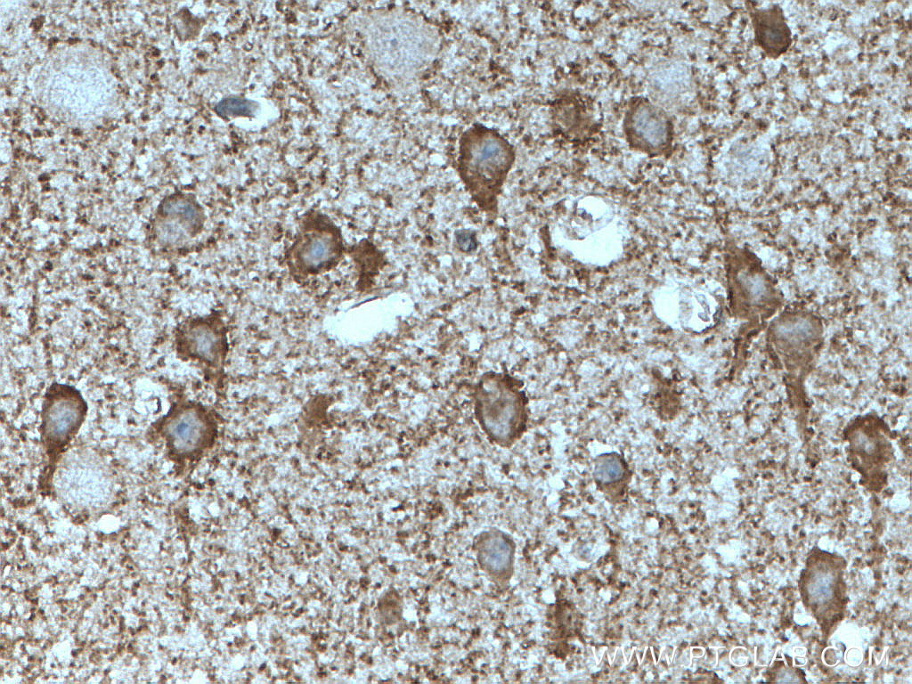 IHC staining of mouse brain using 21760-1-AP