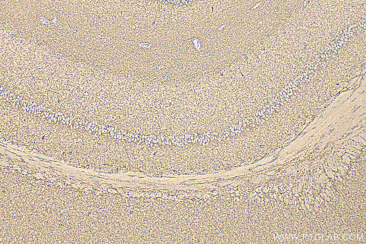 Immunohistochemical analysis of paraffin-embedded mouse brain tissue slide using <a class='green' href='/productredirect?CatalogNo=21760-1-AP' target='_blank'>21760-1-AP</a> (GAD65 antibody) at dilution of 1:400 (under 10x lens). Heat mediated antigen retrieval with Tris-EDTA buffer (pH 9.0). This data was developed using the same antibody clone with 21760-1-PBS in a different storage buffer formulation. IHC staining of mouse brain using 21760-1-AP (same clone as 21760-1-PBS)