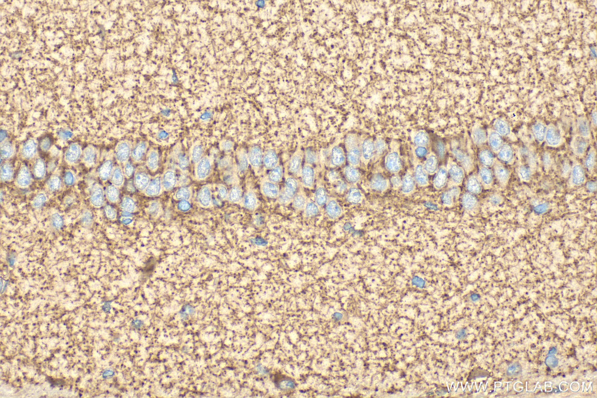 Immunohistochemical analysis of paraffin-embedded mouse brain tissue slide using <a class='green' href='/productredirect?CatalogNo=21760-1-AP' target='_blank'>21760-1-AP</a> (GAD65 antibody) at dilution of 1:400 (under 40x lens). Heat mediated antigen retrieval with Tris-EDTA buffer (pH 9.0). This data was developed using the same antibody clone with 21760-1-PBS in a different storage buffer formulation. IHC staining of mouse brain using 21760-1-AP (same clone as 21760-1-PBS)