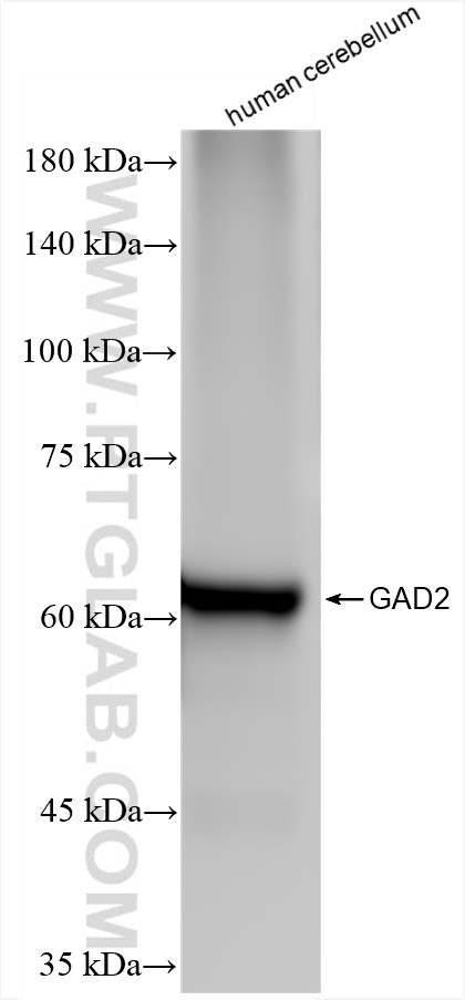 WB analysis of human cerebellum using 85750-1-RR