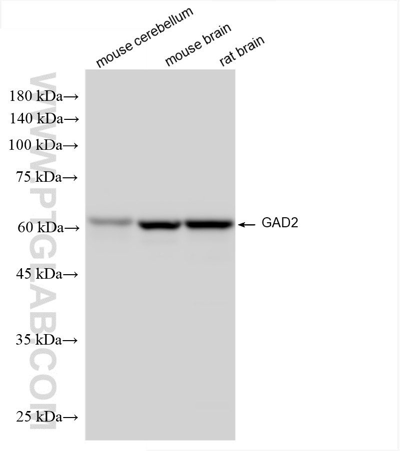 WB analysis using 85750-1-RR
