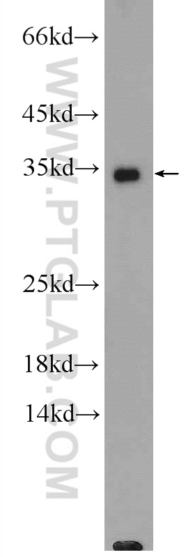 GADD45A Polyclonal antibody