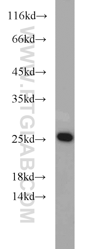 WB analysis of mouse heart using 16260-1-AP