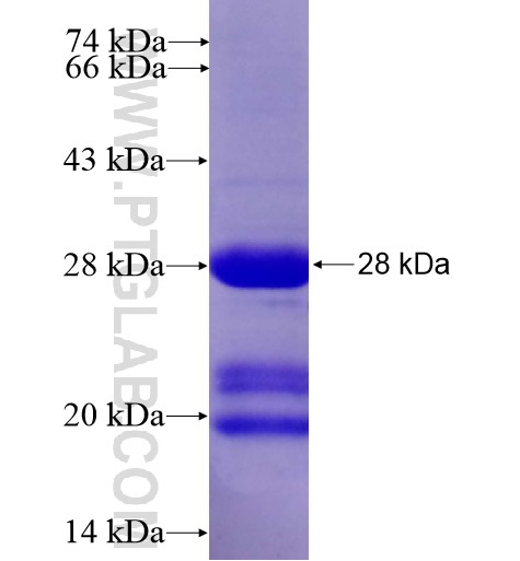 GAGE2A fusion protein Ag12914 SDS-PAGE GAGE2A fusion protein Ag12914 SDS-PAGE