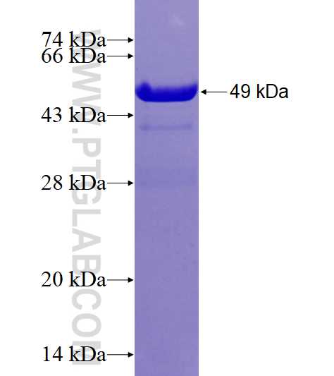 GAGE7 fusion protein Ag4018 SDS-PAGE