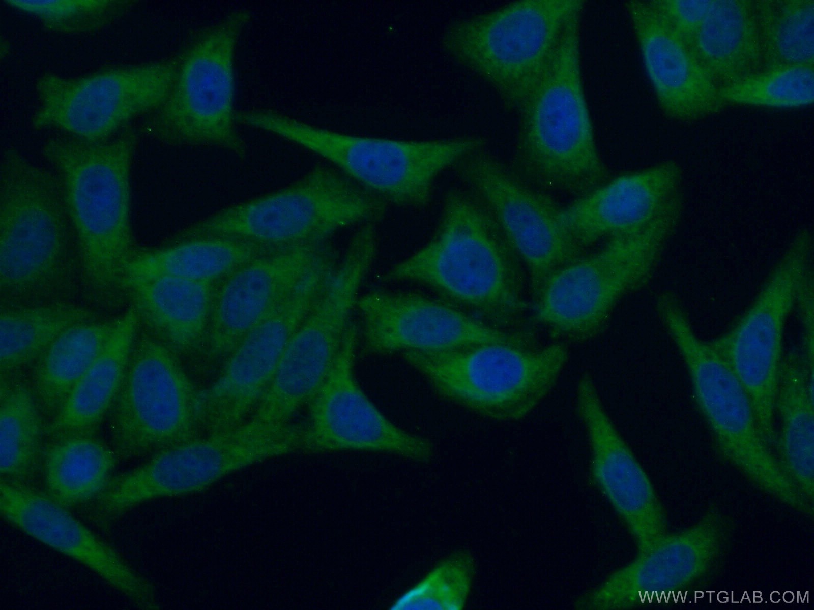 IF Staining of HepG2 using 12147-1-AP