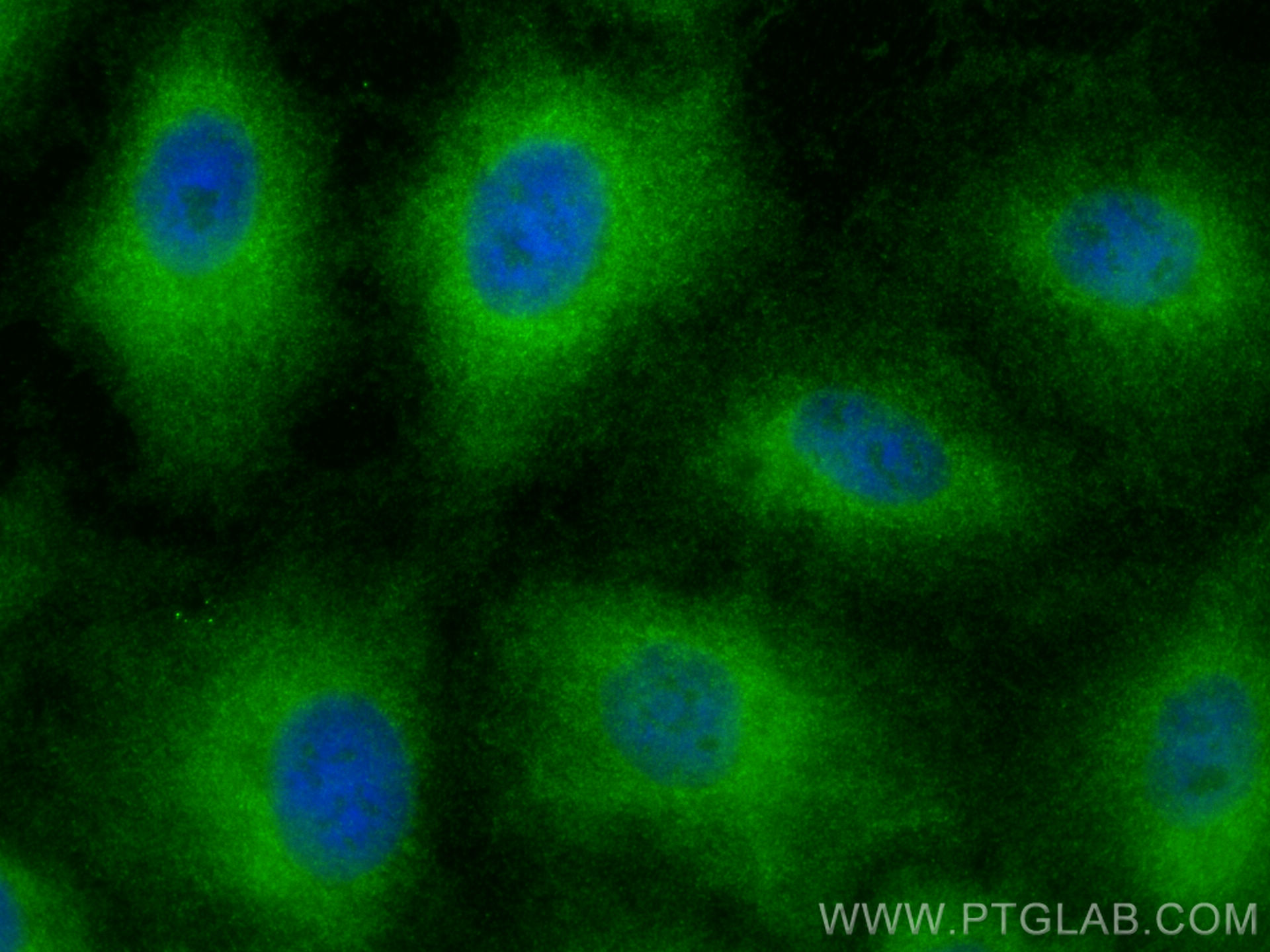 IF Staining of A549 using 11858-1-AP